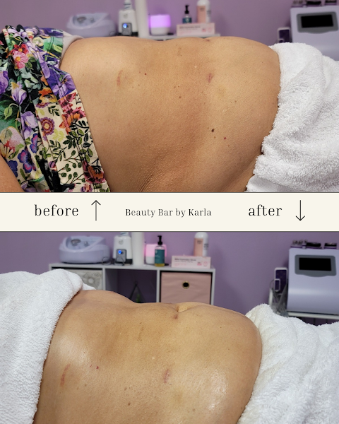 Beauty Bar by Karla Body Contouring
