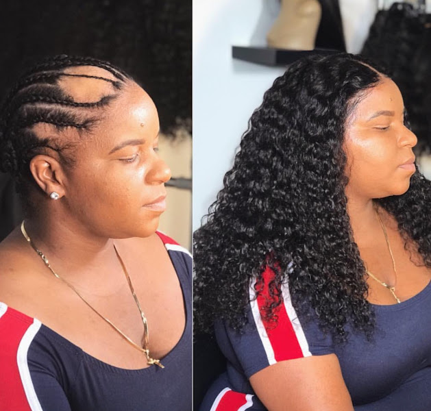 Prosthetic Cranial Hair Loss Specialist