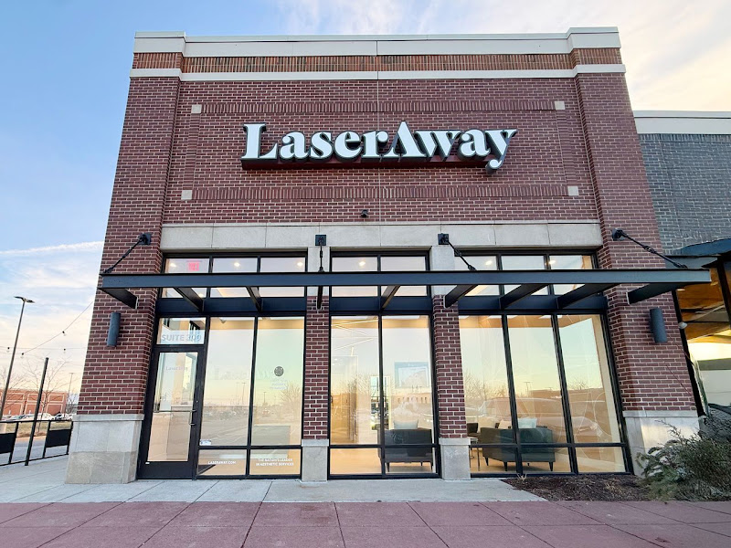 LaserAway Schererville